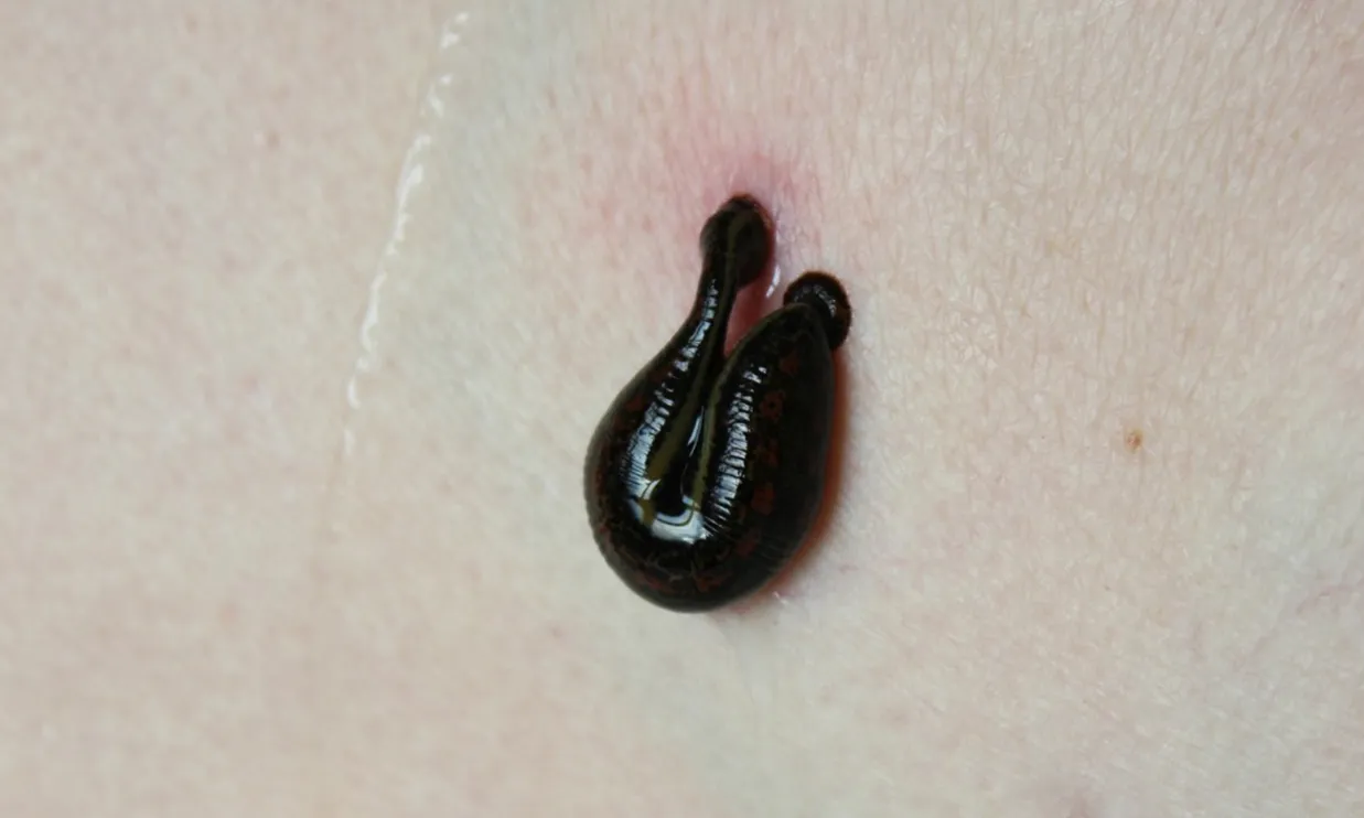 what-are-leeches-06